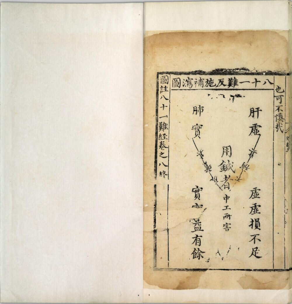 图注八十一难经